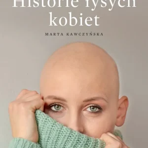 Alopecjanki Historie łysych kobiet