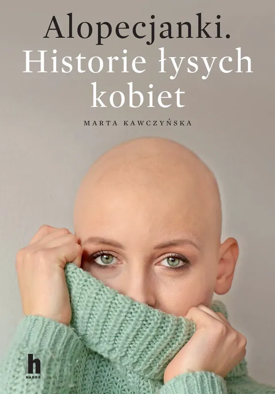 Alopecjanki Historie łysych kobiet