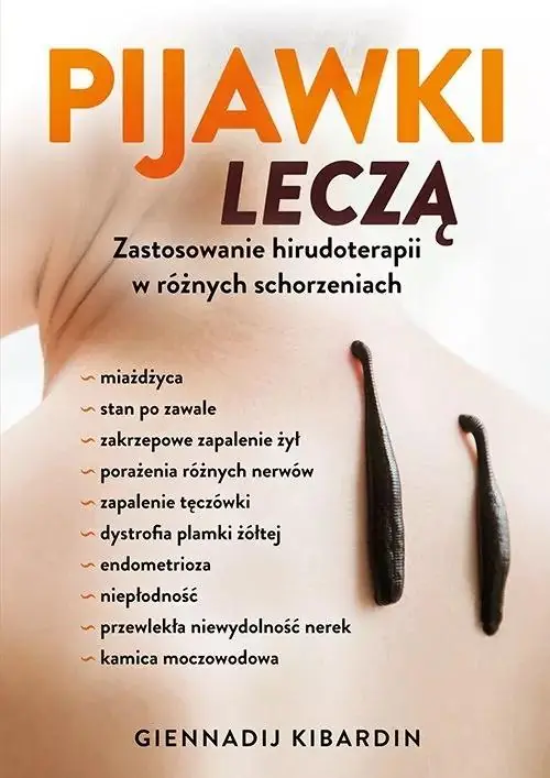 Pijawki leczą. Zastosowanie hirudoterapii w różnych schorzeniach (dodruk 2025)